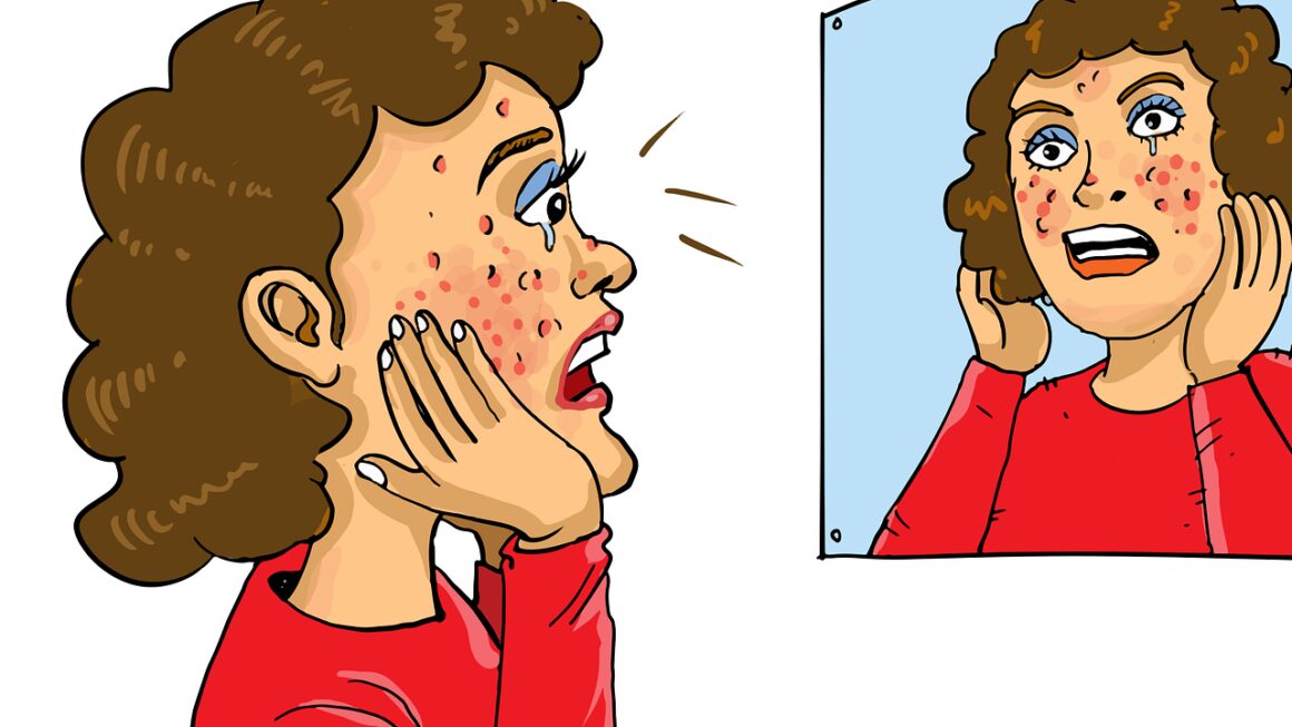 acne, skincare, skin problem